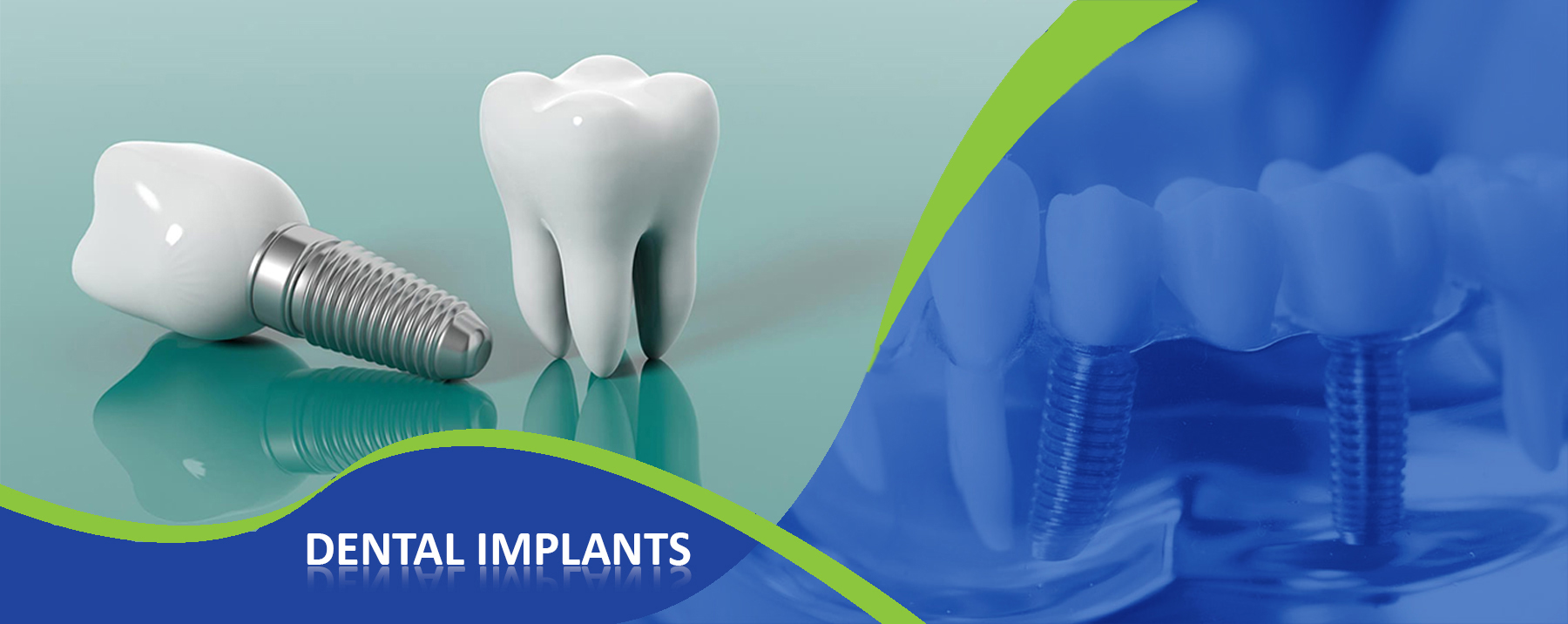 Dental implant clinic