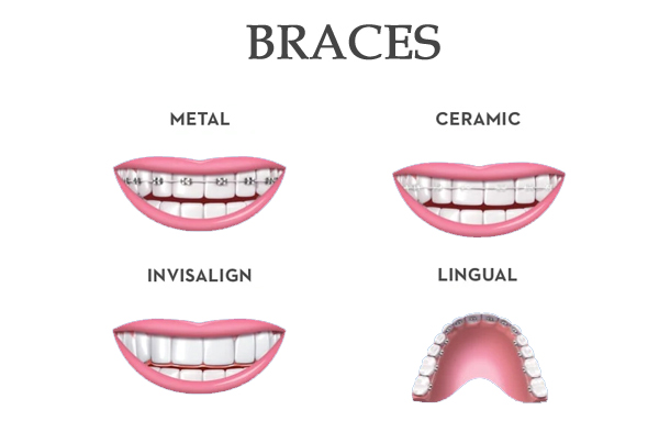 Teeth wire treatment